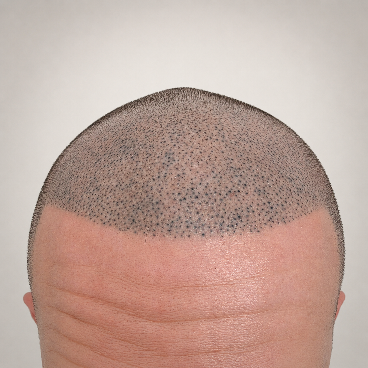 Tricopigmentation : pourquoi les pigments peuvent virer de couleur — et comment l'éviter